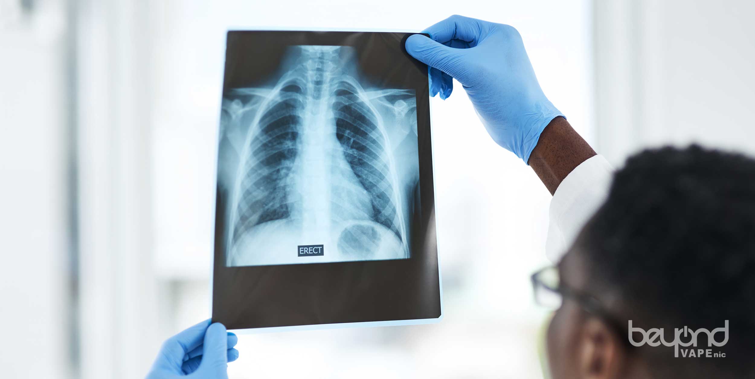 アイコスタール量